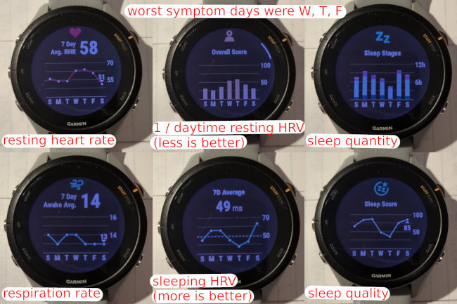 A small multiple collage of graphs from my watch showing health stats when I was sick.